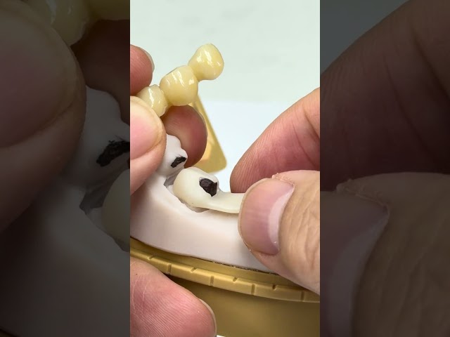 When passing insertion problems!