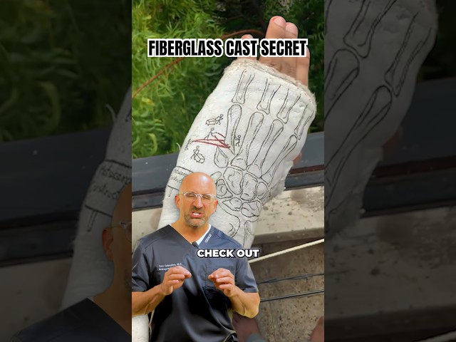 Cast Tip for a Better Broken Bone Experience #shorts