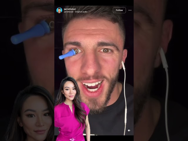 Wearing a prosthetic eye #health #eyes #viral #contactlenses #trending