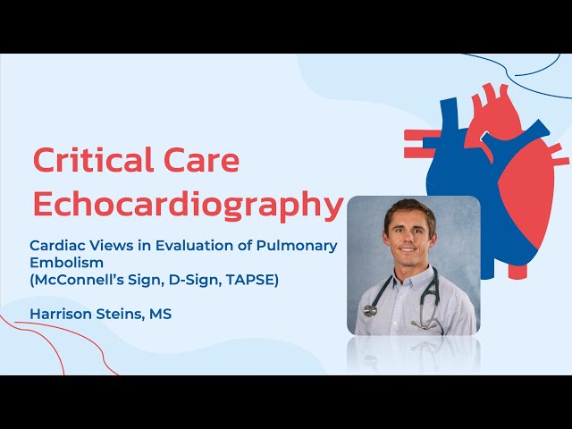 Pulmonary Embolism on Ultrasound: D-Sign, McConnell, and TAPSE: Critical Care Echo