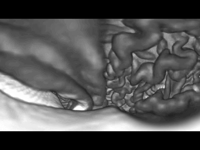 Case Study: Brain MRI Data