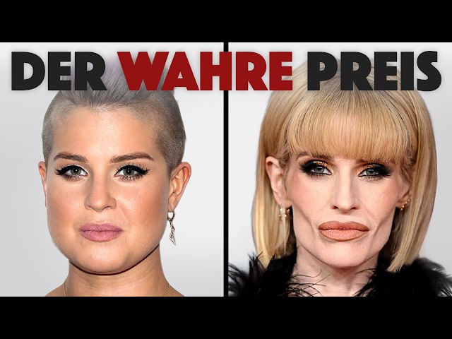 Schlaffe Gesichter & Sammelklagen: Die bittere biologische Quittung von Ozempic & co.