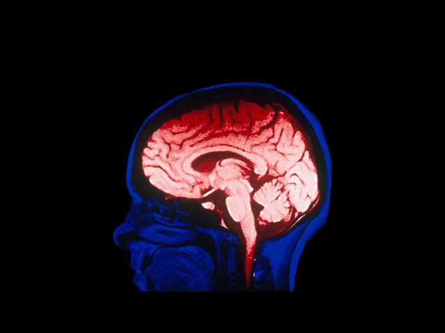 Self-improvement is f***ing your brain