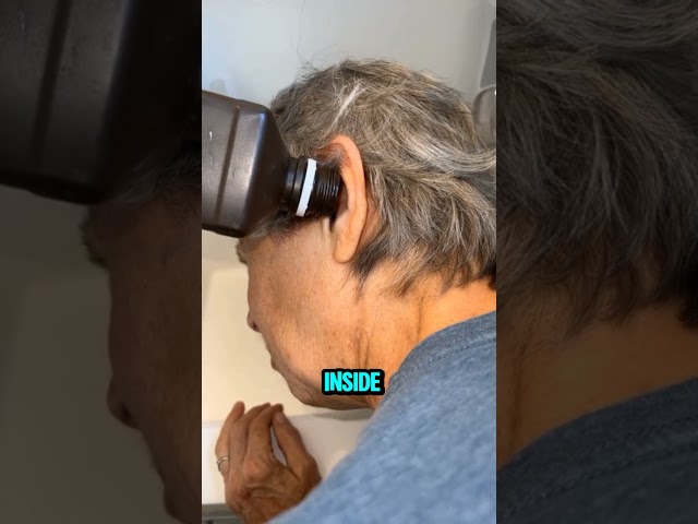 Massive Bug Found inside Ear 😱