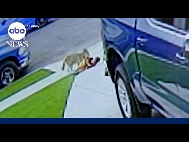 4-year-old attacked by coyote in driveway