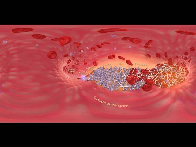 Bloodclot 360 Scene - medmovie.com