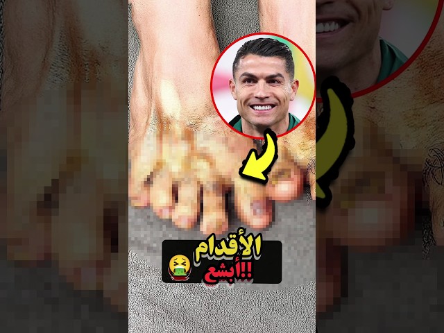 أبشع أقدام في كرة القدم! الأول رح يصدمك 😱👣