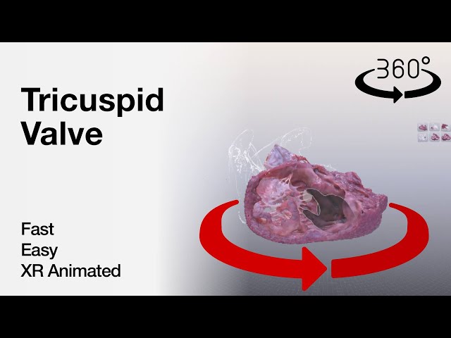 360 video -Tricuspid Valve - Explained in Mixed Reality