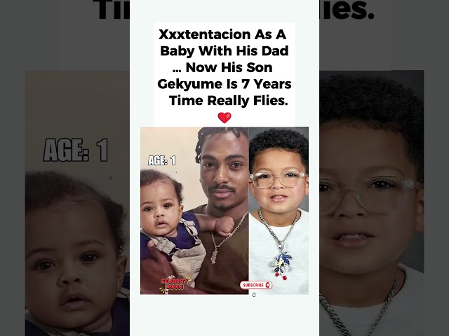 Gekyume is already 7 years old❤️#shorts #xxxtentacion #Gekyume