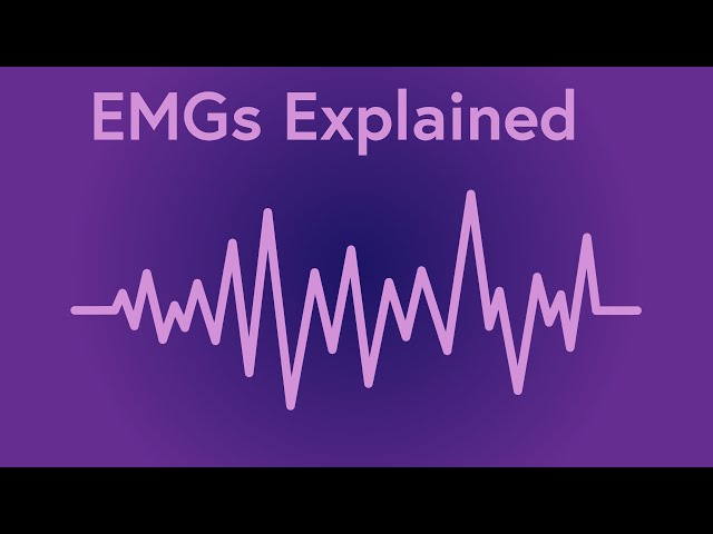 The Technology That Changed Neurology: Electromyography explained   (Ft. Corporis)