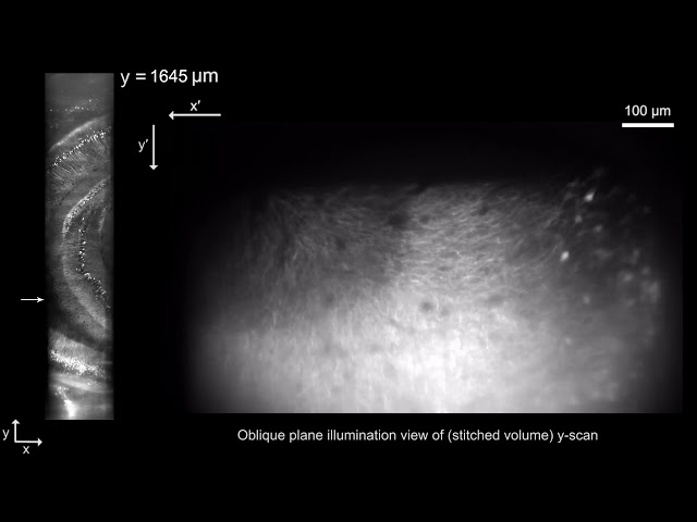 Large volume 3D imaging with SOPi microscopy