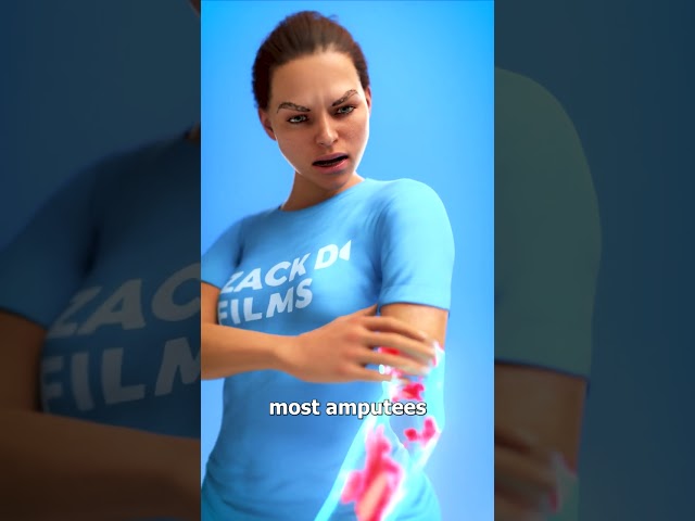 What Is Phantom Limb Pain? 😨