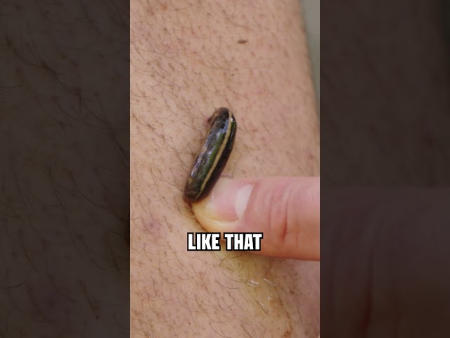 How to REMOVE A LEECH from your skin!