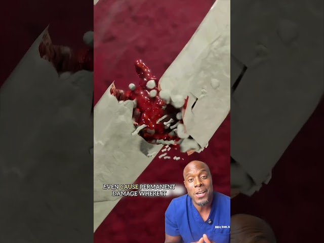 How Fast Do Broken Bones Heal?