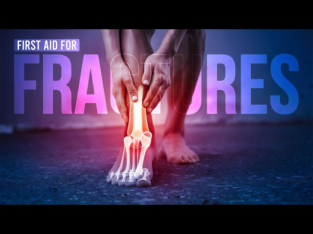 Apollo Hospitals | Immediate Care for Broken Bones: What to Do | First Aid Tips