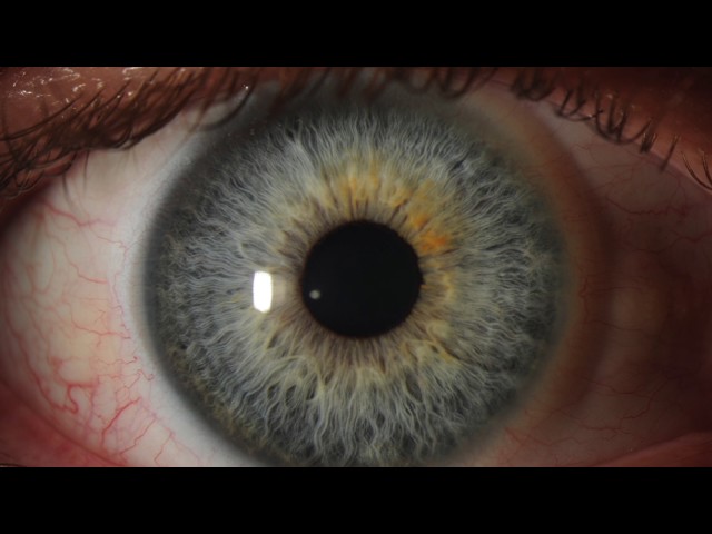 Moran Eye Center Medical Student Ophthalmology Rotation Overview