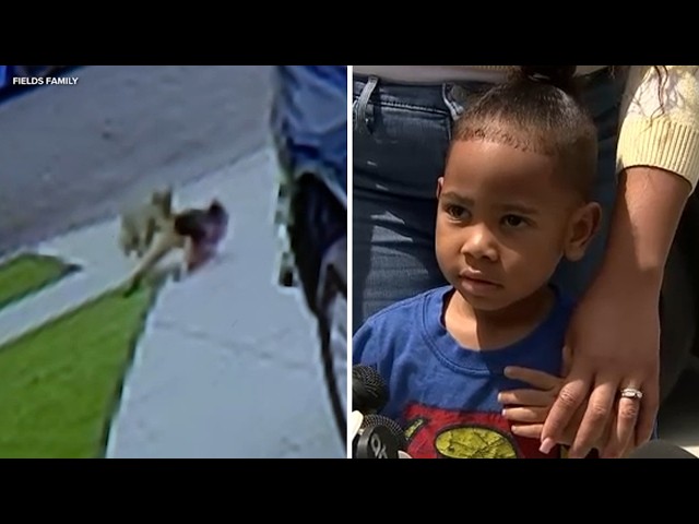 4-year-old boy attacked by coyote in Carson