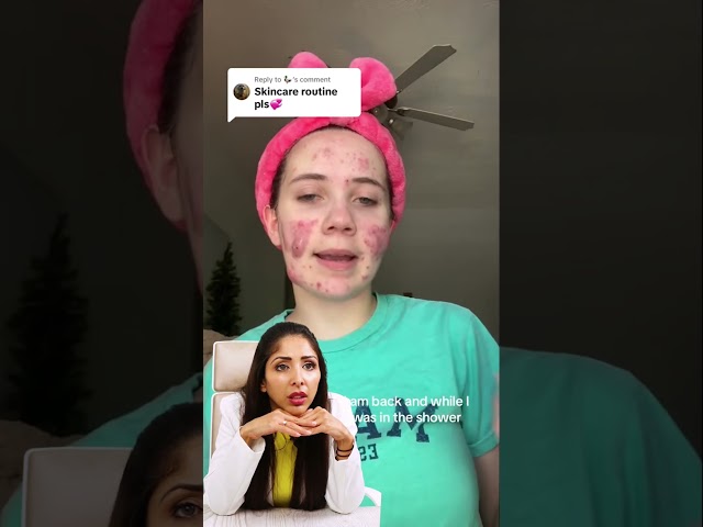 Trio Blemish tagged for mild/ moderate acne in Skin of Colour for acne, red & brown marks #acne