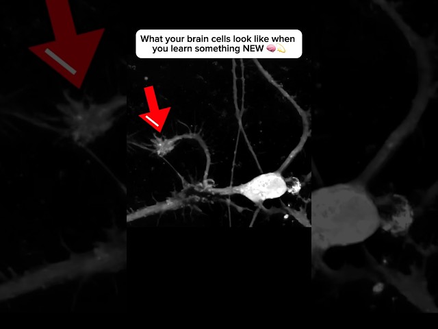 Brain cell restructures itself after forming a new connection #neuroplasticity #neuroscience #brain