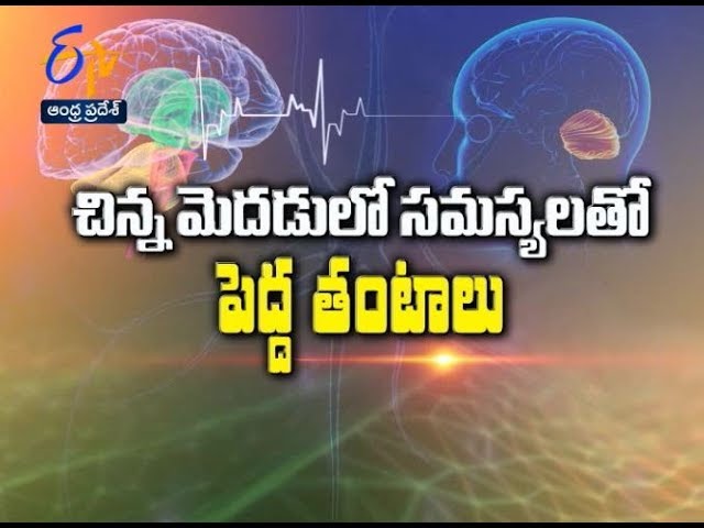Problems In Small Brain | Sukhibhava | 17th September 2018 | ETV Andhra Pradesh