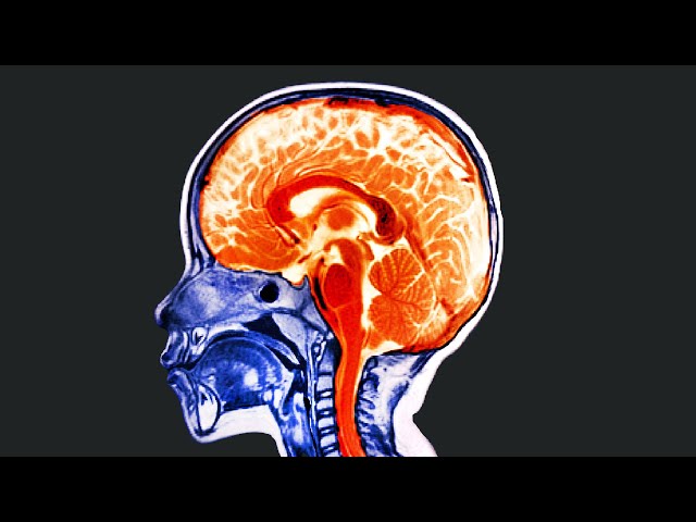 A Boy Drank His Mom's Essential Oils. This Is What Happened To His Brain.