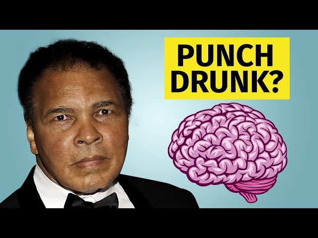 What is CTE | Signs and Symptoms