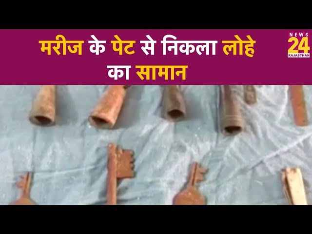 मरीज के पेट से निकली 4 चिलम और लोहे का सामान, देखकर आप भी हो जायेंगे हैरान