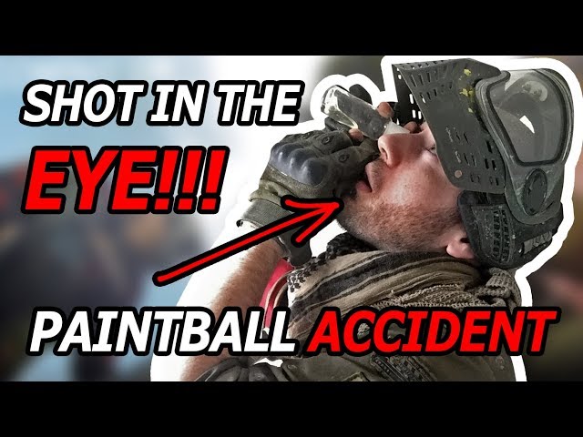 SHOT IN THE EYE - PAINTBALL ACCIDENT - OMG!