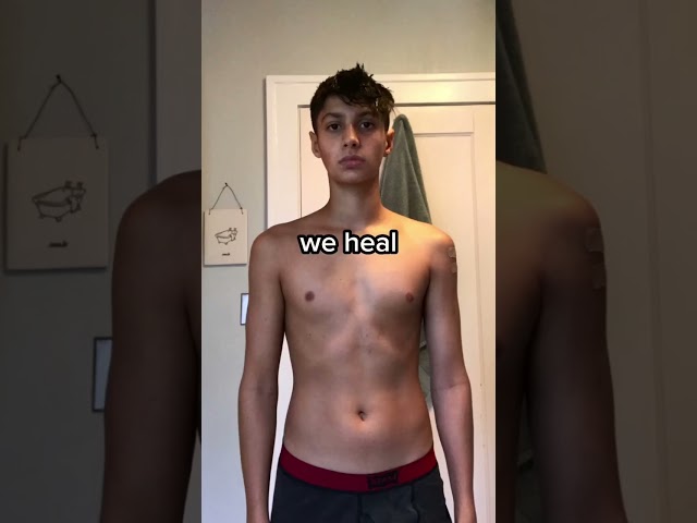 Crazy Teen Body Transformation #fitness #bodybuilding