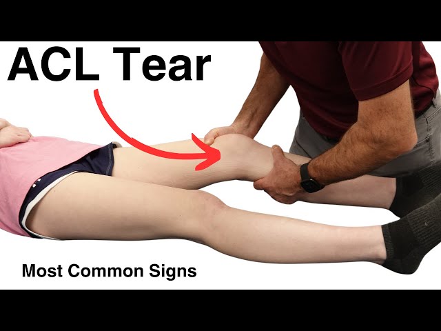 Signs Of An ACL Tear: What You Need To Know!