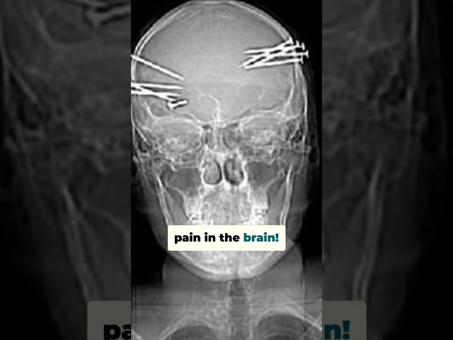 The Top 5 Weirdest X-Ray Images!