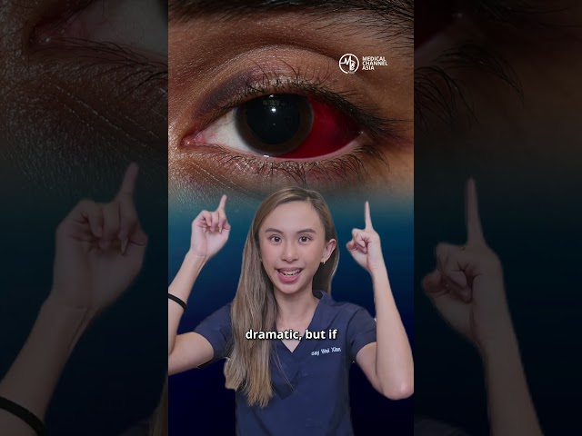 Is your eye bleeding? Don’t panic just yet. 😳