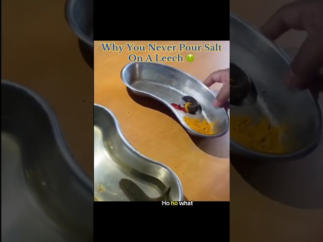 Why You Never Pour Salt On A Leech… 🤢 #gross