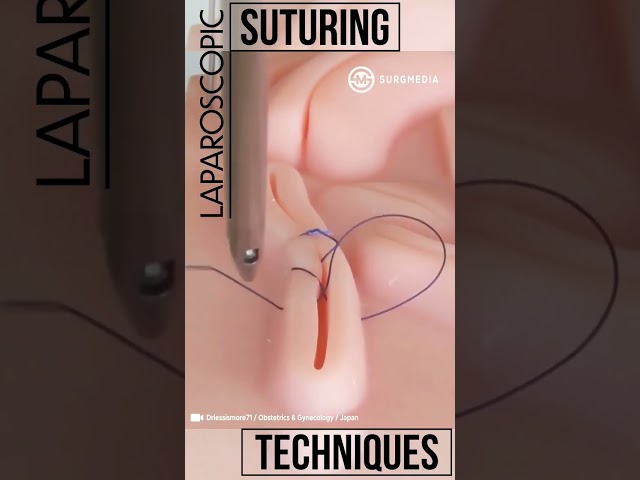 Laparoscopic Suturing Techniques #shorts #tech #suture #training #laparoscopy #medical #medicine