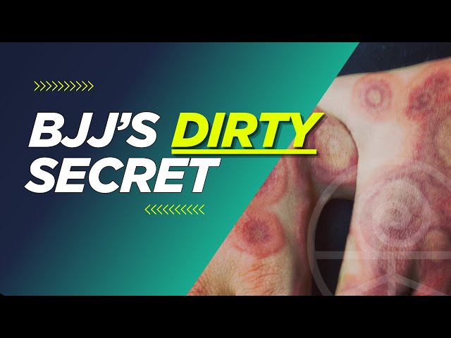 How to Actually Get Rid of Ringworm for Good in Jiu Jitsu (in 10 Minutes)