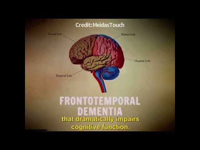 Trump and Dementia (MeidasTouch)