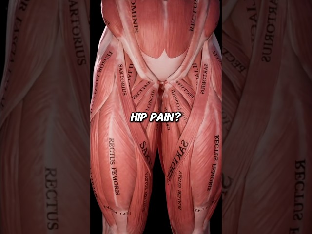 How To Fix Hip Pain (IMPINGEMENT)