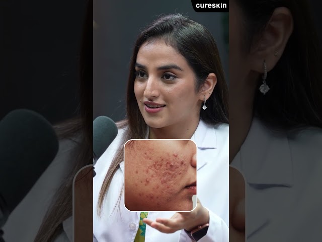 Home remedies may cause more harm than good | Cureskin