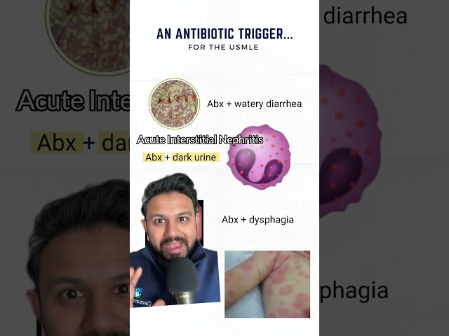 Antibiotic Trigger for the USMLE | HyGuru
