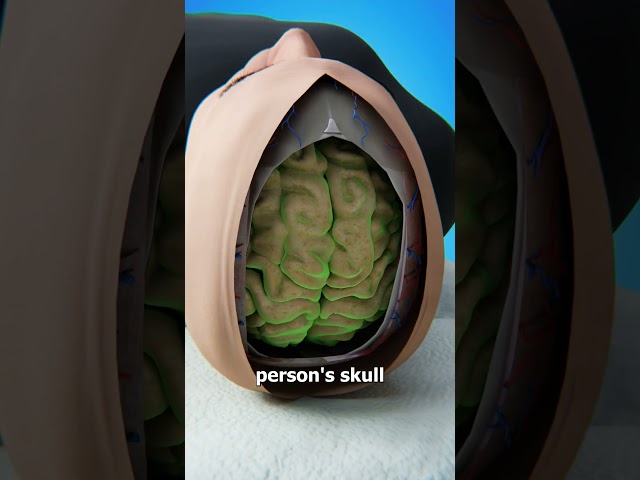 Is It Possible To Swap Brains? 🤔