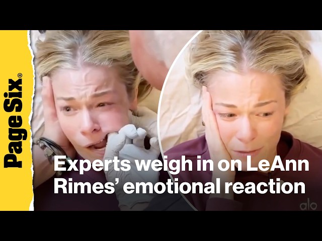 Experts weigh in on LeAnn Rimes' emotional reaction to jaw release therapy: 'Sympathetic response'