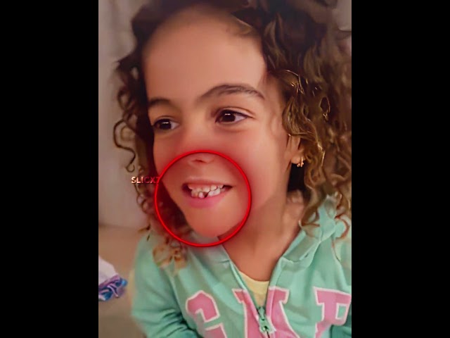Ronaldo's Tooth Prank to Alana 😂