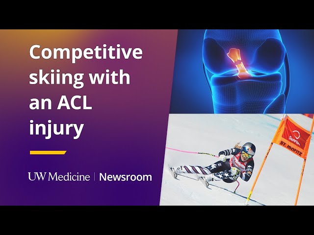 Competitive skiing — with an ACL injury