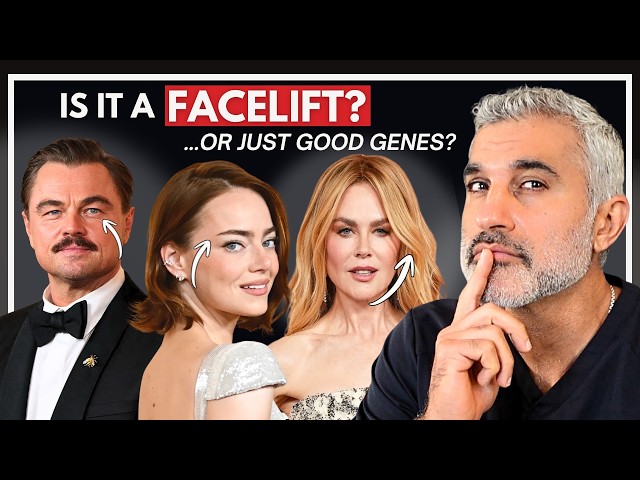Plastic Surgeon Explains Celebrity Facelifts & Transformations at 2026 Oscars