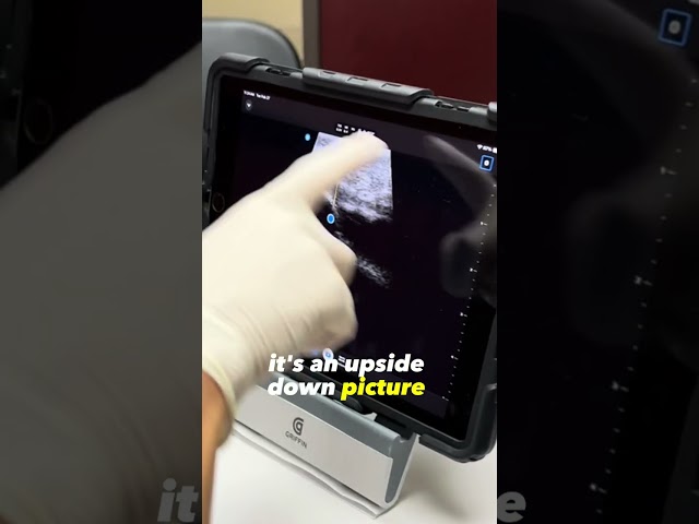 How Do You Know If You Have Plantar Fasciitis? (Doctor Explains)