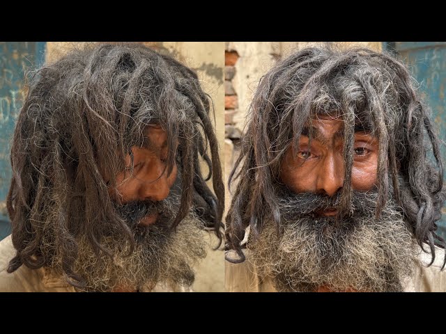 Homeless Man Became A Model | Given A Rich Life Transformation