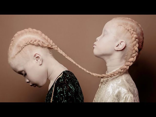 Kids You Won't Believe Exist