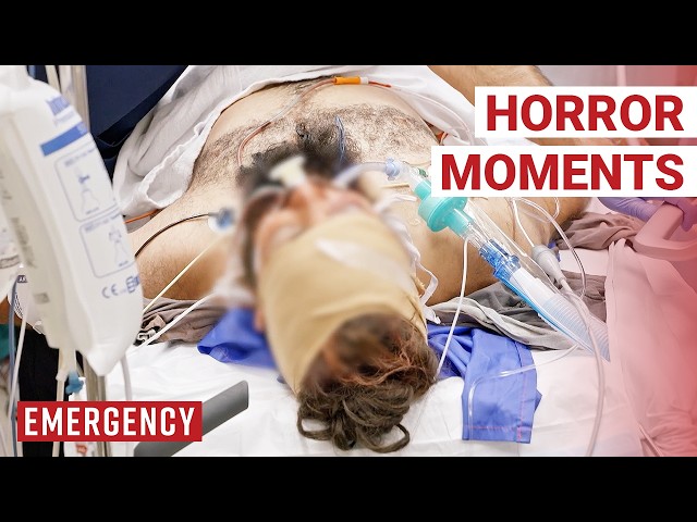 Shocking Workplace Accidents | Emergency