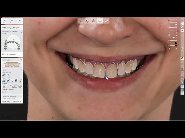 3Shape Smile Design