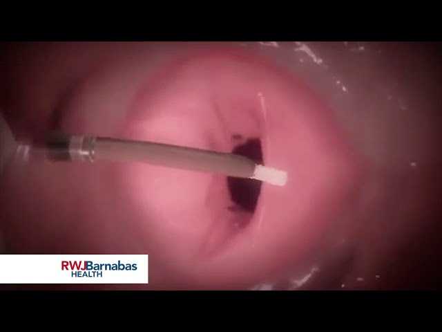 The MitraClip Procedure